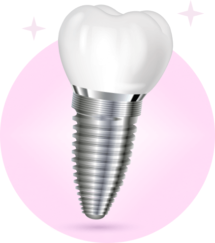 Những ai nên implant?